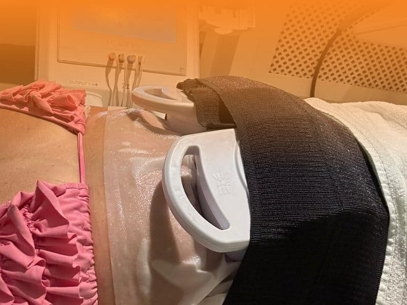 Aplicação de criolipólise de placas no abdômen na Corpory Estética